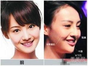 福州整形爆料事件视频,揭露行业黑幕，真相令人震惊